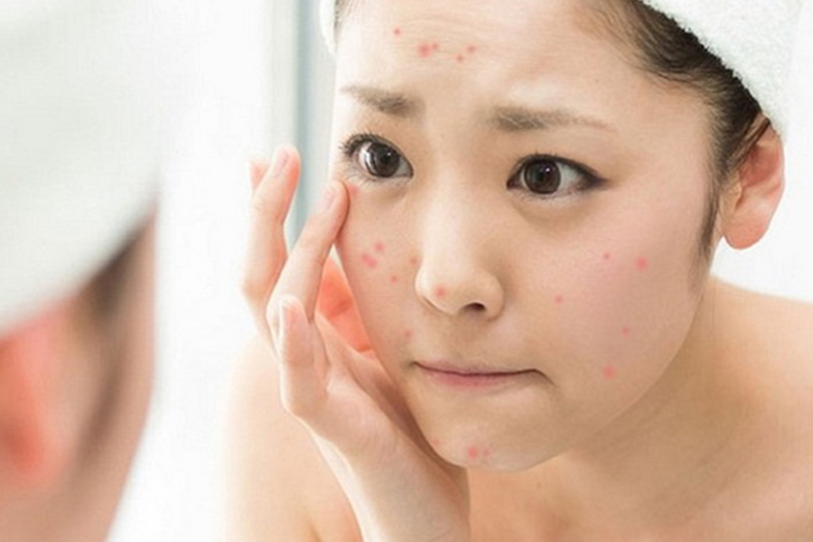 collagen nao tot cho da mun 3 1211c33de2d04360b60a0e1c5b365517