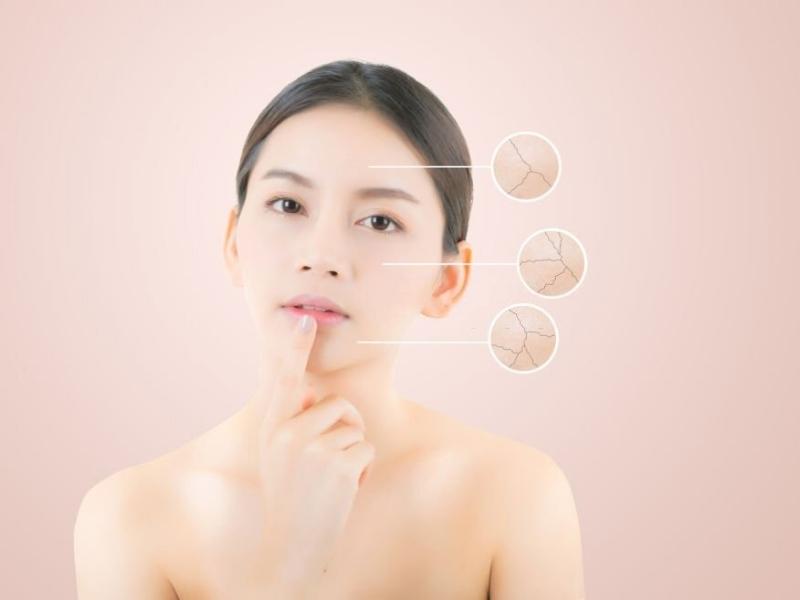 483fe589-kem-lot-cho-da-kho Người phụ nữ chạm môi, nền hồng, minh họa da khô với ba vòng tròn phóng to chi tiết da nứt nẻ.