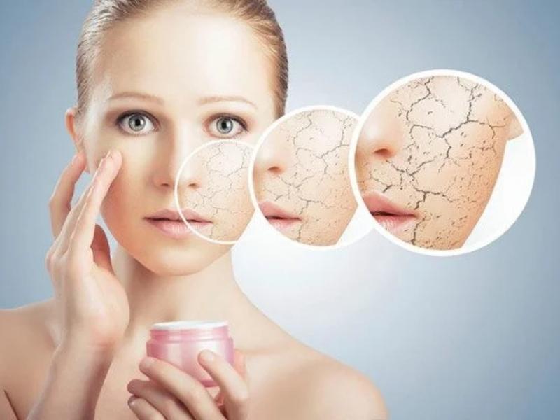 6f8fbe1a-kem-lot-cho-da-kho-23 Người cầm hộp kem, da mặt khô nứt được phóng to trong các vòng tròn để minh họa tình trạng da.