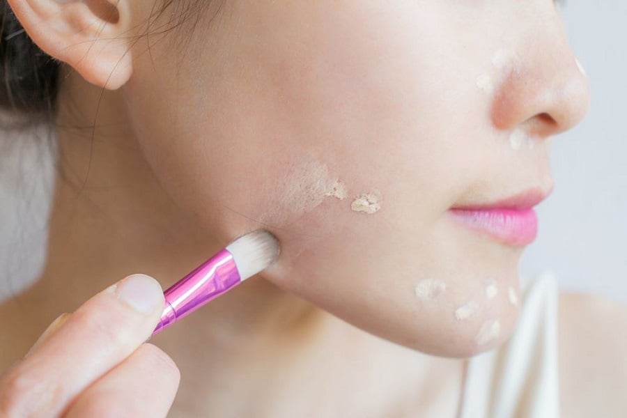 Người đang dùng cọ trang điểm thoa kem che khuyết điểm lên vùng da mặt có vết thâm.