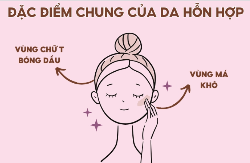 Da hỗn hợp có vùng chữ T thường xuyên tiết dầu, trong khi hai má khô ráp