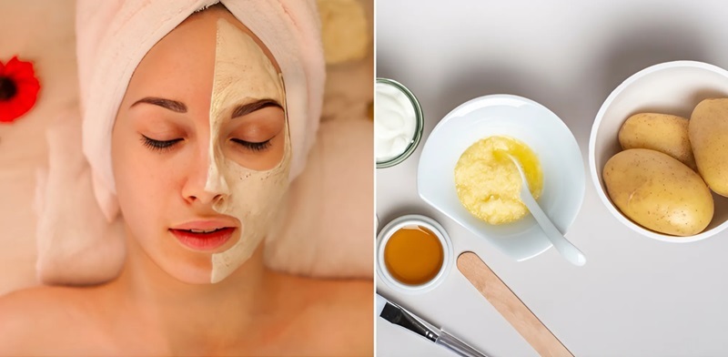 Bên trái: người thư giãn với mặt nạ dưỡng da. Bên phải: nguyên liệu tự nhiên gồm khoai tây, mật ong, sữa chua.