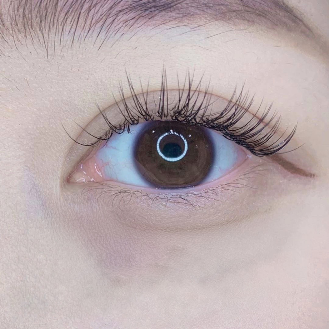 noi mi tu nhien han quoc jpg1 jpg1 1