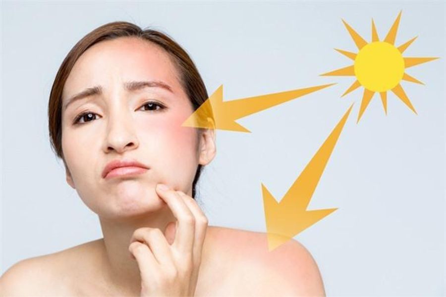 Người phụ nữ chạm vào mặt, biểu cảm khó chịu, với hình ảnh mặt trời và tia nắng chỉ vào mặt.