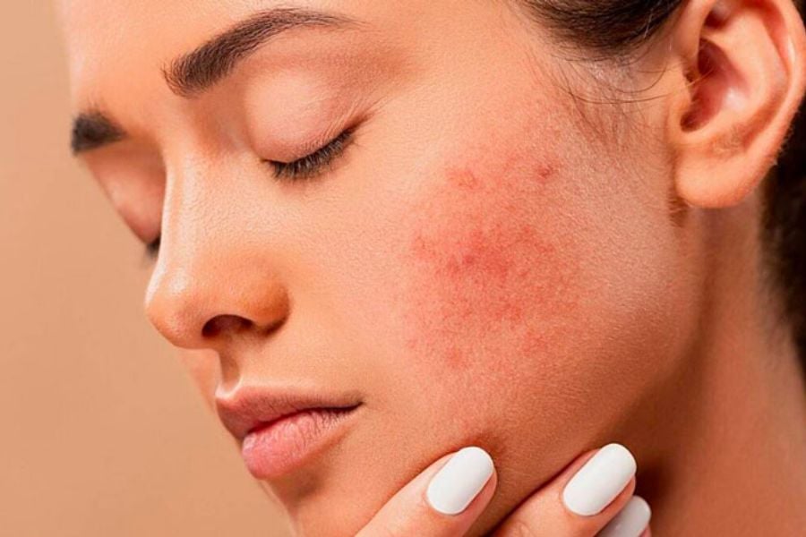 Nguyên nhân dẫn đến da sần sùi?