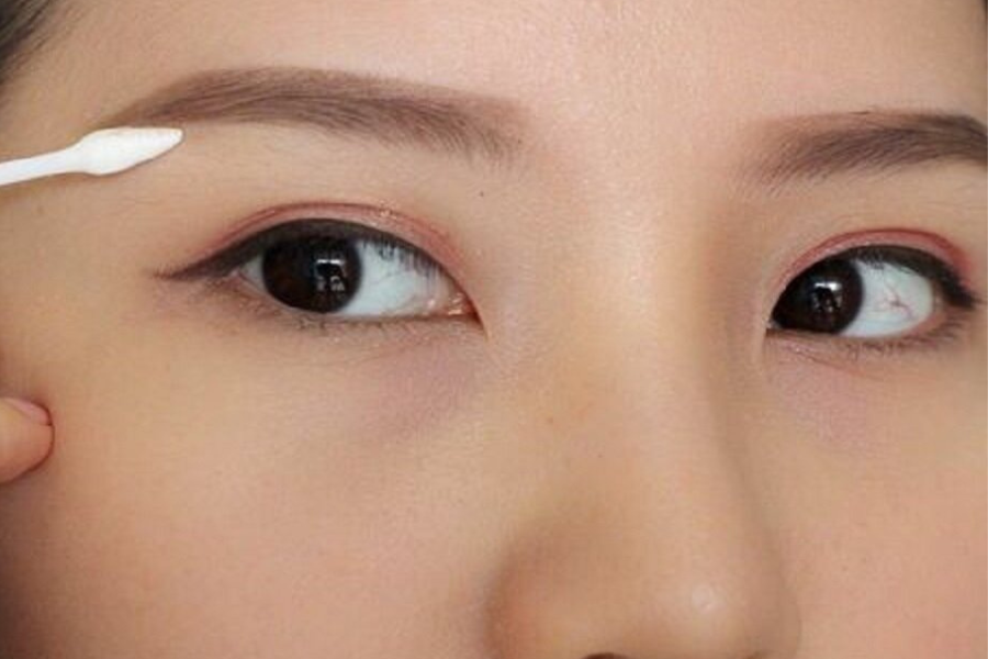 Cận cảnh một người đang dùng tăm bông làm sạch vùng da gần lông mày.