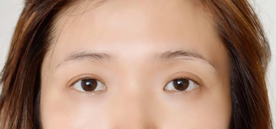 Cận cảnh đôi mắt và phần trán của một người, với tóc màu nâu sáng.