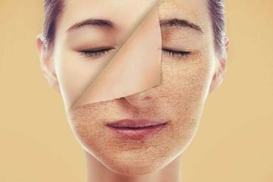 Hình ảnh một khuôn mặt với làn da mịn màng và nứt nẻ, thể hiện sự khác biệt trong tình trạng da.