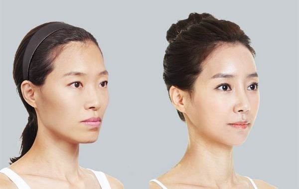 kieu-toc-cho-mat-hoc-hac__23__0e0f1429f3a9490199e2314659c1a572 Đặc điểm khuôn mặt gầy, má hóp